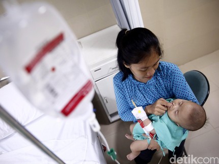 Cara Mencegah Bayi Lahir dengan Bibir Sumbing