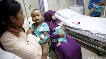 Harga Perbaikan Bibir Sumbing dengan BPJS