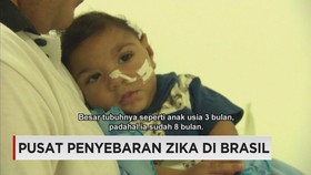 Dampak Virus Zika pada Bayi