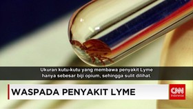 Gejala dan Pencegahan Penyakit Lyme