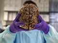 Mencegah Stroke, Penyakit yang Diderita Robby Tumewu