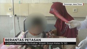 Petasan Meledak Mengenai Wajah Bocah 10 Tahun