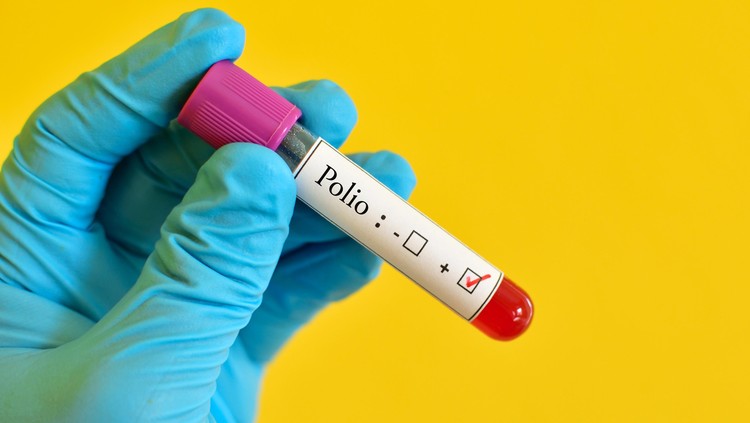 Ini waktu yang tepat memberi vaksin polio pada anak.