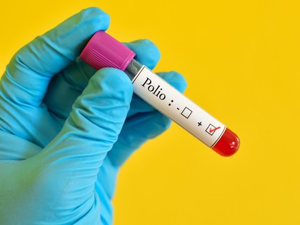 Vaksin Polio, Ini Waktu Tepat Diberikan pada Anak