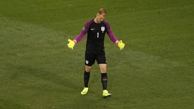 Joe Hart Minta Maaf Lakukan Blunder