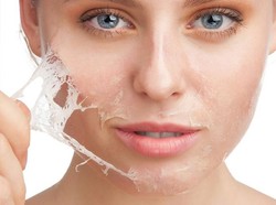 7 Cara Mengatasi Kulit Kering dan Mengelupas