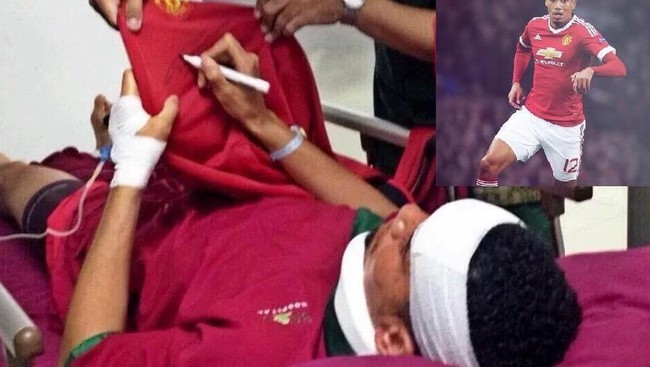 Bek Manchester United, Chris Smalling, diduga mengalami kecelakaan saat belajar beselancar di Bali lantaran disengat ubur-ubur.