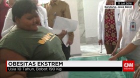 Anak dengan Obesitas Ekstrem Jalani Perawatan