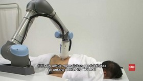 Kenalkan Emma, Robot Pijat Tradisional Tuina Khas China