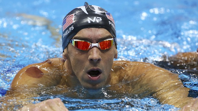 Sejumlah atlet Amerika Serikat macam perenang kelas dunia, Michael Phelps dan atlet senam artistik Alex Naddour, juga mengandalkan bekam.
