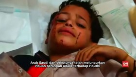 Serangan Udara Hantam Sekolah di Yaman, 10 Anak Tewas