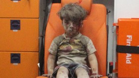 Foto Tatapan Bocah Aleppo Bikin Netizen Terenyuh