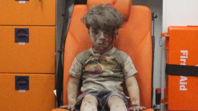 Omran Daqneesh, 5 tahun, hanya terdiam dengan kepala mengucurkan darah, tubuhnya penuh debu dari rumahnya yang hancur akibat serangan udara di Aleppo.