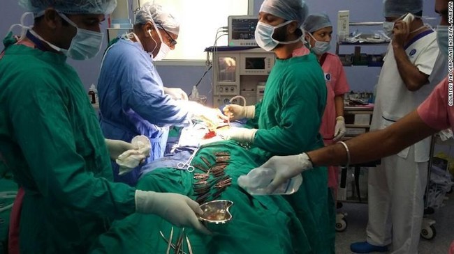 Tim dokter di India mengeluarkan 40 pisau lipat dari perut seorang pria, yang jika dipanjangkan berukuran sekitar 17,8 cm.