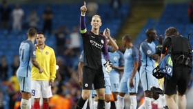Laga Spesial Joe Hart Lawan Steaua