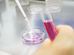 4 Fakta Virus G4, Varian Baru Flu Babi yang Disebut Potensial Jadi Pandemi