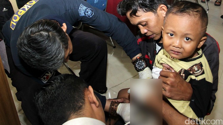 Untuk membantu anak lebih berani disunat, ada hypnokhitan yang bisa dilakukan nih, Bun. Kayak apa sih?