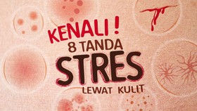Kenali 8 Tanda Stres Lewat Kulit