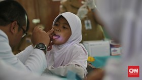 Virus HPV Bisa Menular Lewat Mulut dan Tangan