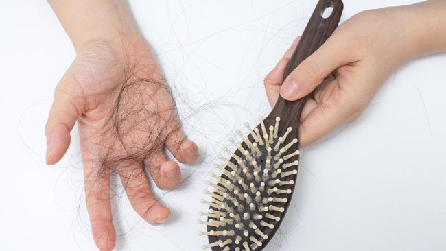 Ada beberapa alasan mengapa rambut bisa mengalami kerontokan masif dan menyebabkan kebotakan dini.