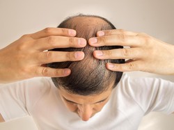Rambut Jadi Indra Peraba Manusia yang Baru? Begini Kata Para Ilmuwan