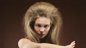 Genetik Jadi Biang Kerok 'Rambut Singa'
