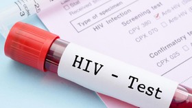 Separuh Orang dengan HIV di Dunia Tak Tahu Status Infeksinya