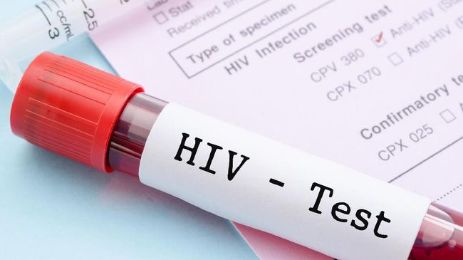 Separuh Orang dengan HIV di Dunia Tak Tahu Status Infeksinya WHO mengingatkan hampir separuh orang dengan HIV (ODH) di dunia tidak mengetahui status infeksi mereka.