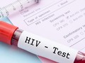Separuh Orang dengan HIV di Dunia Tak Tahu Status Infeksinya
