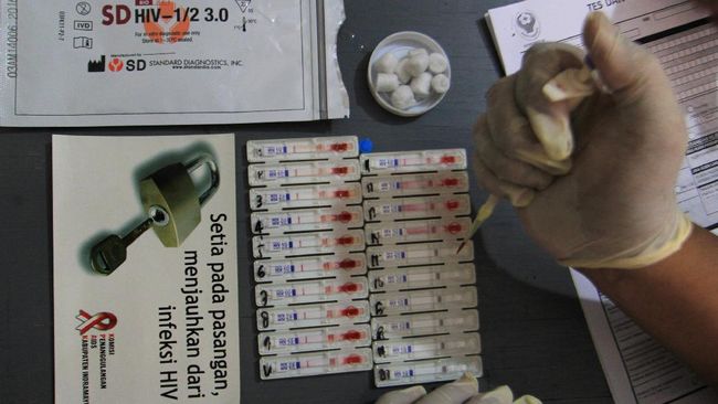 Bekerjasama dengan organisasi HIV/AIDS Internasional, pemerintah Kabupaten Pangandaran kini memiliki klinik pengobatan Anti Retroviral (ARV) pertama.