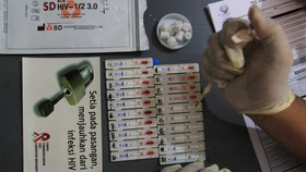 Atasi HIV/AIDS, Klinik Pengobatan ARV Jangkau Masyarakat