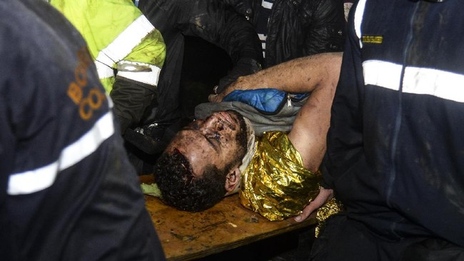 Neto, bek Chapecoense yang selamat dalam kecelakan pesawat LAMIA Airlines bahkan masih belum mengetahui musibah yang menimpa dirinya dan rekan-rekan klub.