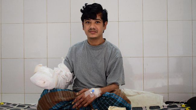 Abul Bajandar telah menjalani 16 operasi pengangkatan lima kilogram kutil dan kini bersiap jadi orang pertama di dunia yang sembuh dari penyakit langka itu.