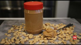 Cara Cegah Alergi Kacang Sejak Usia Dini