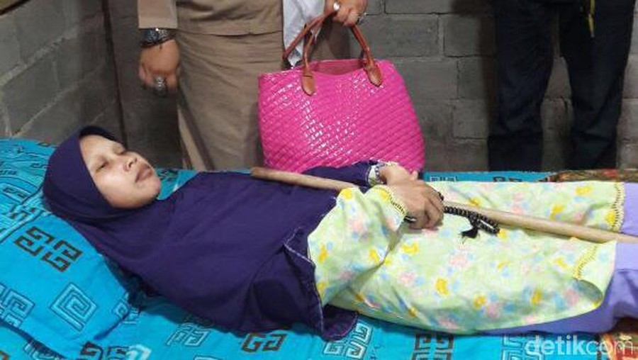 Sulami, warga Selorejo RT 31/11 Mojokerto, Kedawung, Sragen yang mengalami kelainan sehingga sekujur tubuhnya kaku