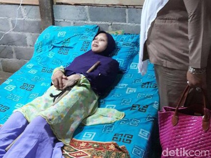 Kisah Sulami Lawan Penyakit 'Manusia Kayu' hingga Akhir Hayat, Tinggalkan Pesan Terakhir