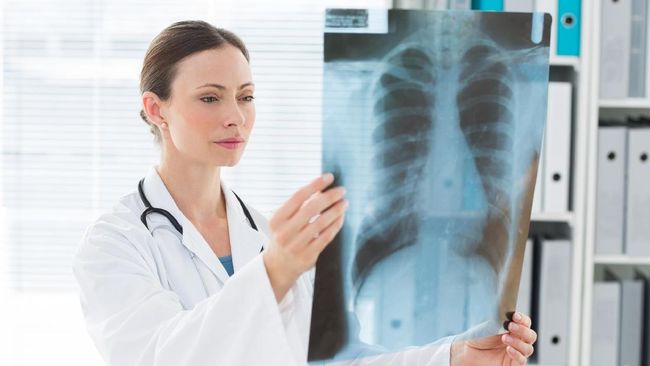 Penyakit tuberculosis disebut menjadi penyakit menular paru-paru paling berbahaya di sepanjang 2016. WHO menilai upaya cegah penularan TBC masih rendah.