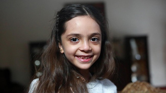 Bana al-Abed, meminta Donald Trump menolong anak-anak Suriah dari penderitaan berkepanjangan akibat perang sipil yang masih melanda negara itu.