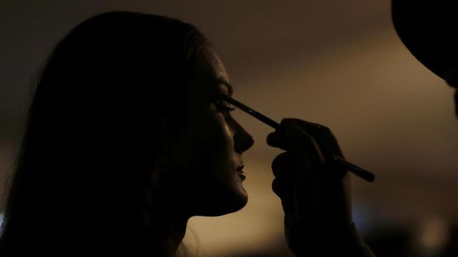 Dipanggil 'Dalmation', perempuan Barcelona, Alba Parejo (16) memiliki sekitar 500 tanda lahir berupa bintik-bintik cokelat dan hitam di sekujur tubuhnya.