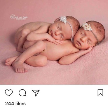Lahir di Tengah Pandemi, Bayi Kembar Ini Diberi Nama Corona dan Covid