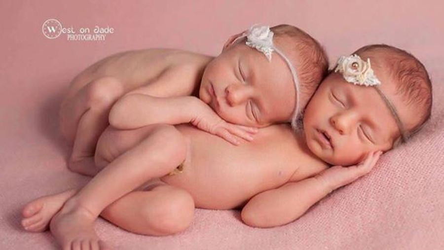 Sepasang bayi kembar diberi nama Corona dan Covid.