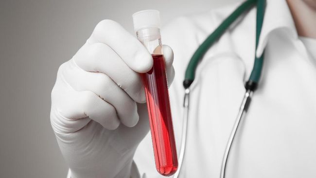 Sejumlah peneliti menemukan pengobatan terbaru untuk HIV/AIDS yang dapat membuat seseorang hidup hingga satu dekade lebih lama.