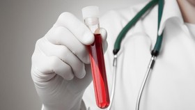Mengenal Teknik Edit DNA Crispr, Si Penghenti Virus HIV