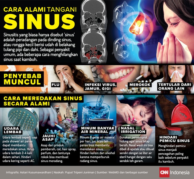 Sinusitis yang biasa hanya disebut 'sinus' adalah peradangan pada dinding sinus, atau rongga kecil berisi udah di belakang tulang pipi dan dahi.