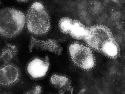 Anak 11 Tahun di Kamboja Meninggal Akibat Flu Burung!