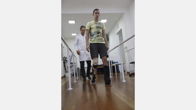 Bangkit dari Tragedi Chapecoense dengan Kaki Buatan