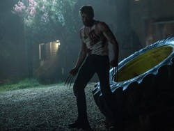Hugh Jackman Cedera Pita Suara Gegara Perankan Wolverine