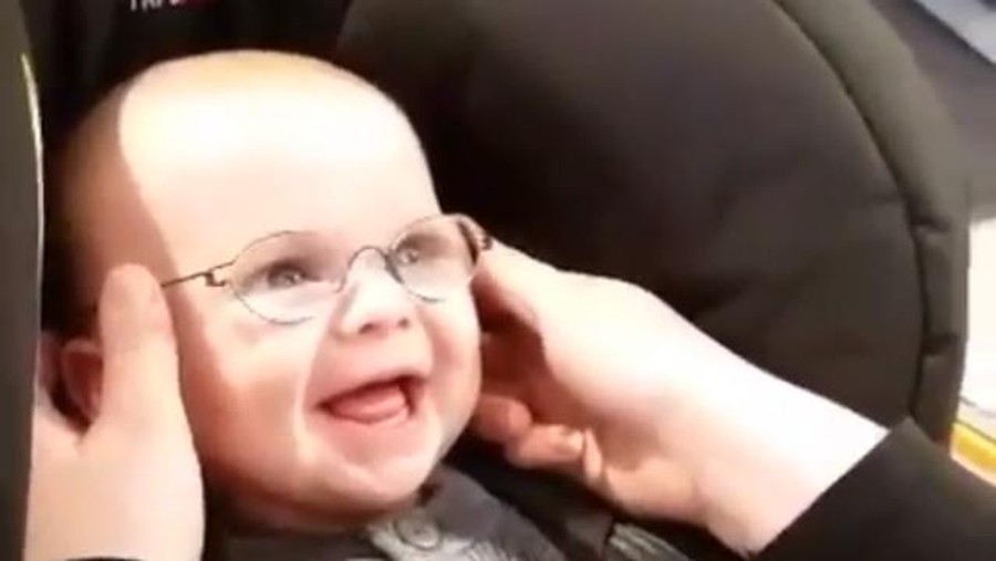 Kenali Penyebab Katarak pada Bayi Seperti Dialami Anak Asri Welas