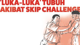 'Luka-luka' Tubuh Akibat Skip Challenge