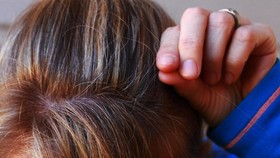 7 Cara Mengatasi Rambut Beruban Tanpa Perlu Disemir
